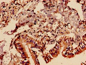 PREX1 Antibody