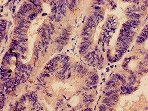 PREX1 Antibody