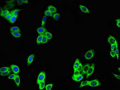 PREX2 Antibody