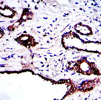 PRK2 Antibody