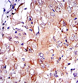 PRK2 Antibody