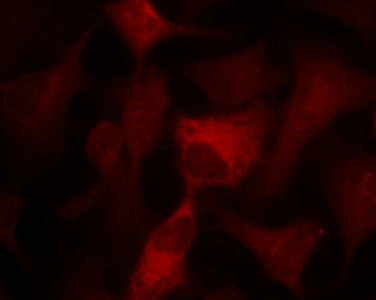 PRKAA1 (Ab-174/172) Antibody