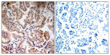PRKAA1 (Ab-174/172) Antibody