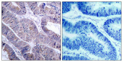 PRKAA1/PRKAA2 (Ab-487) Antibody