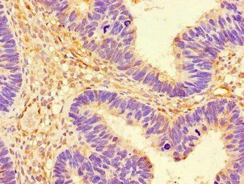 PRKAA1 Antibody