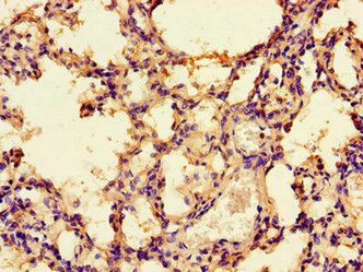 PRKAA1 Antibody
