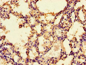 PRKAA1 antibody