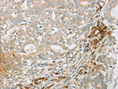 PRKAA1 Antibody