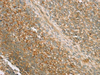 PRKAA1 Antibody