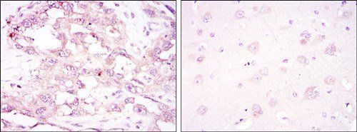 PRKAA1 Antibody