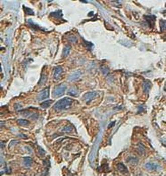PRKAA1 Rabbit Polyclonal Antibody