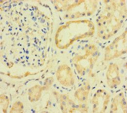 PRKAA2 Antibody