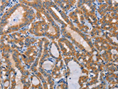 PRKAA2 Antibody
