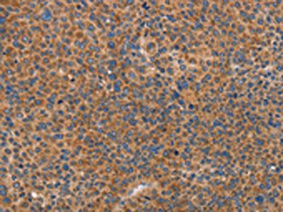 PRKAA2 Antibody