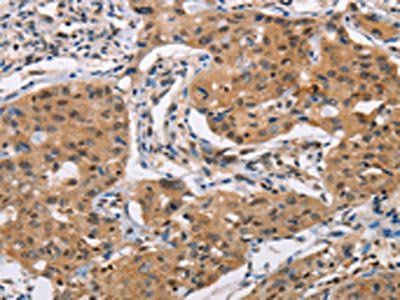 PRKAA2 Antibody