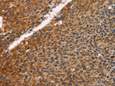 PRKAA2 Antibody