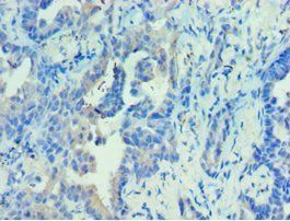 PRKAB2 Antibody