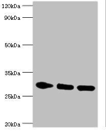 PRKAB2 Antibody