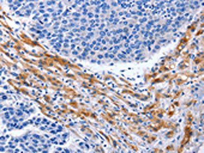 PRKAB1 Antibody