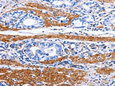 PRKAB1 Antibody