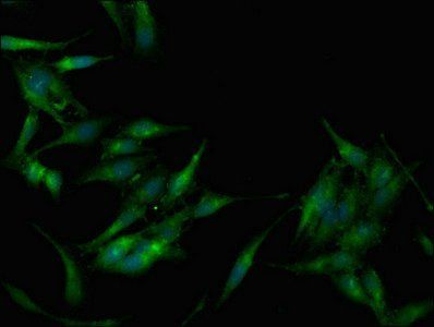 PRKAB1 Antibody