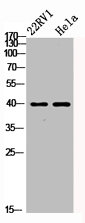 PRKACA/PRKACB/PRKACG Antibody