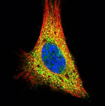 PRKACA Rabbit Polyclonal Antibody