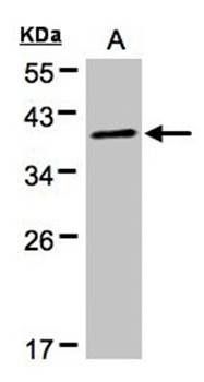 PRKACA Rabbit Polyclonal Antibody