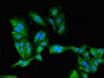 PRKACB Antibody