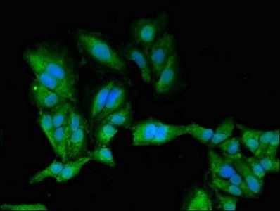 PRKACB antibody