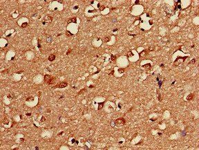PRKACB Antibody
