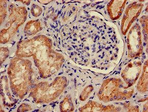 PRKACB Antibody