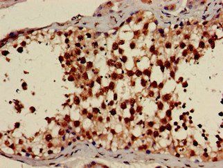 PRKAG1 Antibody