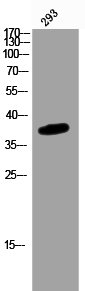 PRKAG1/PRKAG2/PRKAG3 Antibody
