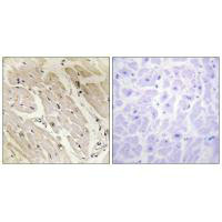 PRKAG2 Antibody