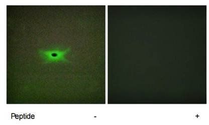 PRKAG2 Antibody