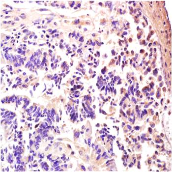 AMPK gamma 3 Rabbit Polyclonal Antibody