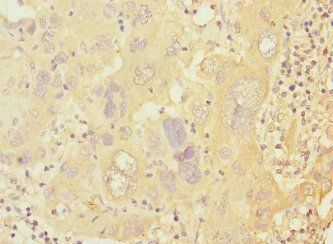 PRKAR1B Antibody