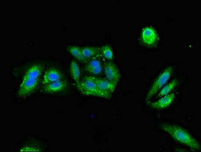 PRKAR2A Antibody