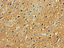 PRKAR2A Antibody
