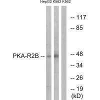 PRKAR2B (Ab-113) Antibody