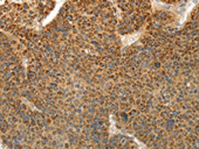 PRKCA Antibody