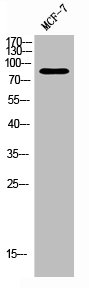 PRKCA/PRKCB/PRKCD/PRKCE/PRKCG/PRKCH/PRKCQ/PRKCZ Antibody