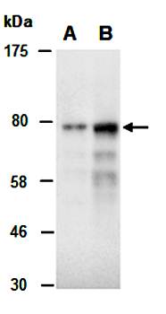 PRKCA (M1) Antibody, Rabbit Polyclonal