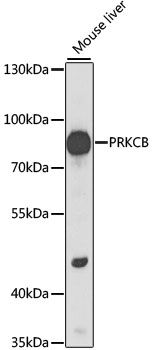 PRKCB antibody