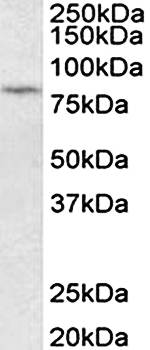 PRKCB Antibody