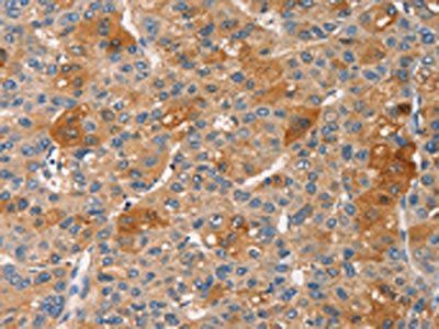 PRKCE Antibody