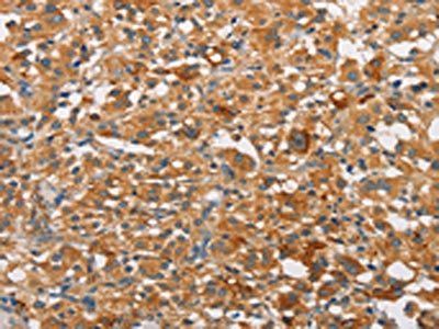 PRKCE Antibody