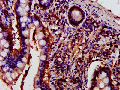 PRKCH Antibody