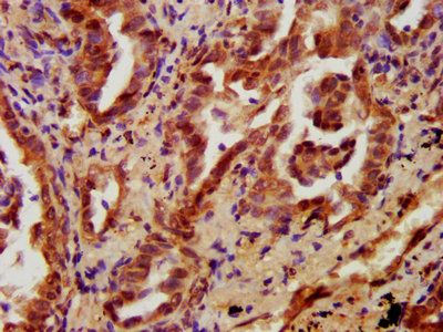 PRKCH Antibody